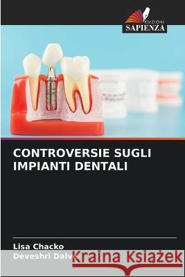 Controversie Sugli Impianti Dentali Lisa Chacko Deveshri Dalve  9786205976852 Edizioni Sapienza