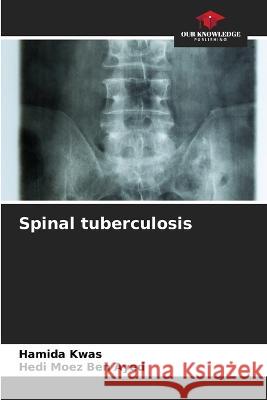 Spinal tuberculosis Hamida Kwas Hedi Moez Ben Ayed  9786205978962