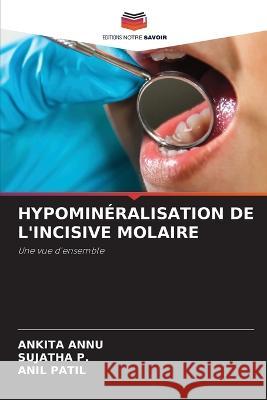 Hypomineralisation de l'Incisive Molaire Ankita Annu Sujatha P Patil 9786205982396