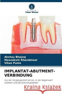 Implantat-Abutment-Verbindung Akshay Bhojraj Meenakshi Khandelwal Vikas Punia 9786205994023