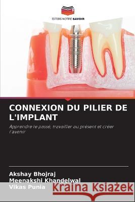 Connexion Du Pilier de l'Implant Akshay Bhojraj Meenakshi Khandelwal Vikas Punia 9786205994047