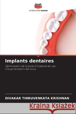 Implants dentaires Divakar Thiruvenkata Krishnan   9786206001539