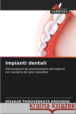 Impianti dentali Divakar Thiruvenkata Krishnan   9786206001546