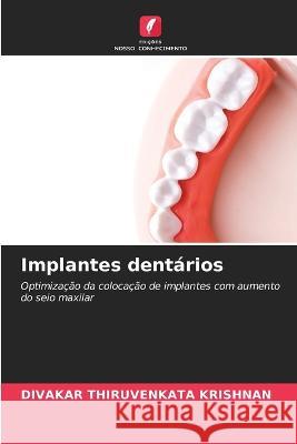 Implantes dentarios Divakar Thiruvenkata Krishnan   9786206001553