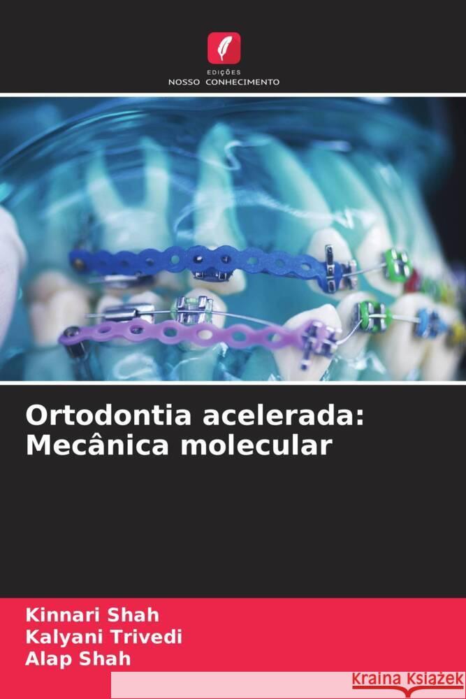 Ortodontia acelerada: Mecanica molecular Kinnari Shah Kalyani Trivedi Alap Shah 9786206007692