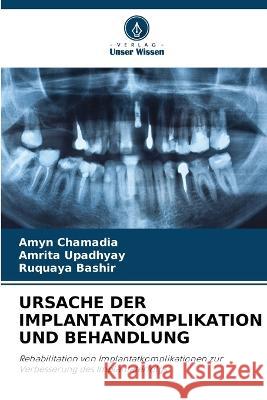 Ursache Der Implantatkomplikation Und Behandlung Amyn Chamadia Amrita Upadhyay Ruquaya Bashir 9786206013402