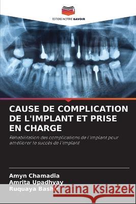 Cause de Complication de l'Implant Et Prise En Charge Amyn Chamadia Amrita Upadhyay Ruquaya Bashir 9786206013426