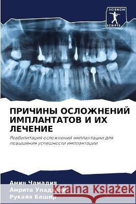 PRIChINY OSLOZhNENIJ IMPLANTATOV I IH LEChENIE Chamadiq, Amin, Upadh'qj, Amrita, Bashir, Rukajq 9786206013457 Sciencia Scripts