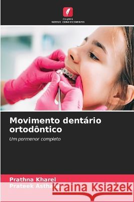 Movimento dentario ortodontico Prathna Kharel Prateek Asthana  9786206025948 Edicoes Nosso Conhecimento