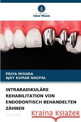 Intraradikulare Rehabilitation Von Endodontisch Behandelten Zahnen Priya Mishra Ajay Kumar Nagpal  9786206027324