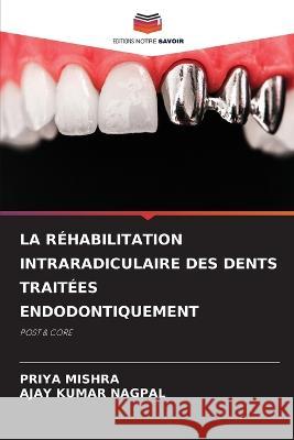 La Rehabilitation Intraradiculaire Des Dents Traitees Endodontiquement Priya Mishra Ajay Kumar Nagpal  9786206027348