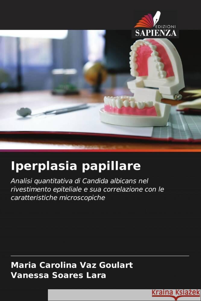 Iperplasia papillare Maria Carolina Vaz Goulart Vanessa Soares Lara  9786206036951