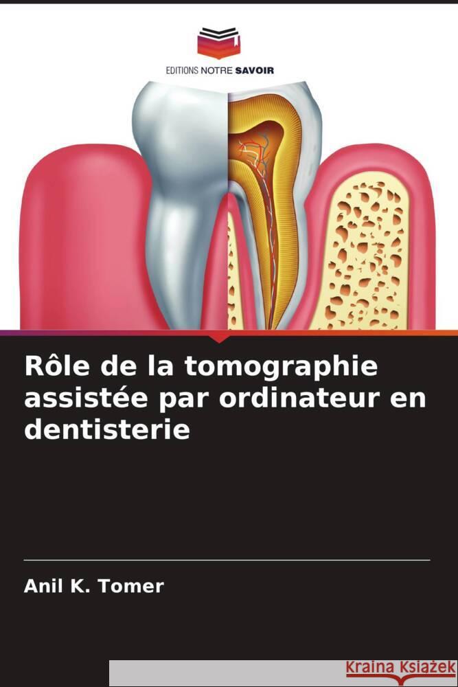 Role de la tomographie assistee par ordinateur en dentisterie Anil K Tomer   9786206038450 Editions Notre Savoir