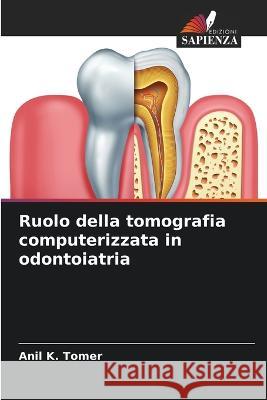 Ruolo della tomografia computerizzata in odontoiatria Anil K Tomer   9786206038467 Edizioni Sapienza
