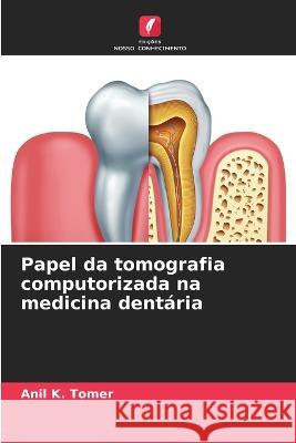 Papel da tomografia computorizada na medicina dentaria Anil K Tomer   9786206038474 Edicoes Nosso Conhecimento