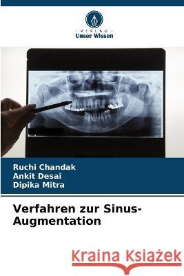 Verfahren zur Sinus-Augmentation Ruchi Chandak Ankit Desai Dipika Mitra 9786206045397 Verlag Unser Wissen