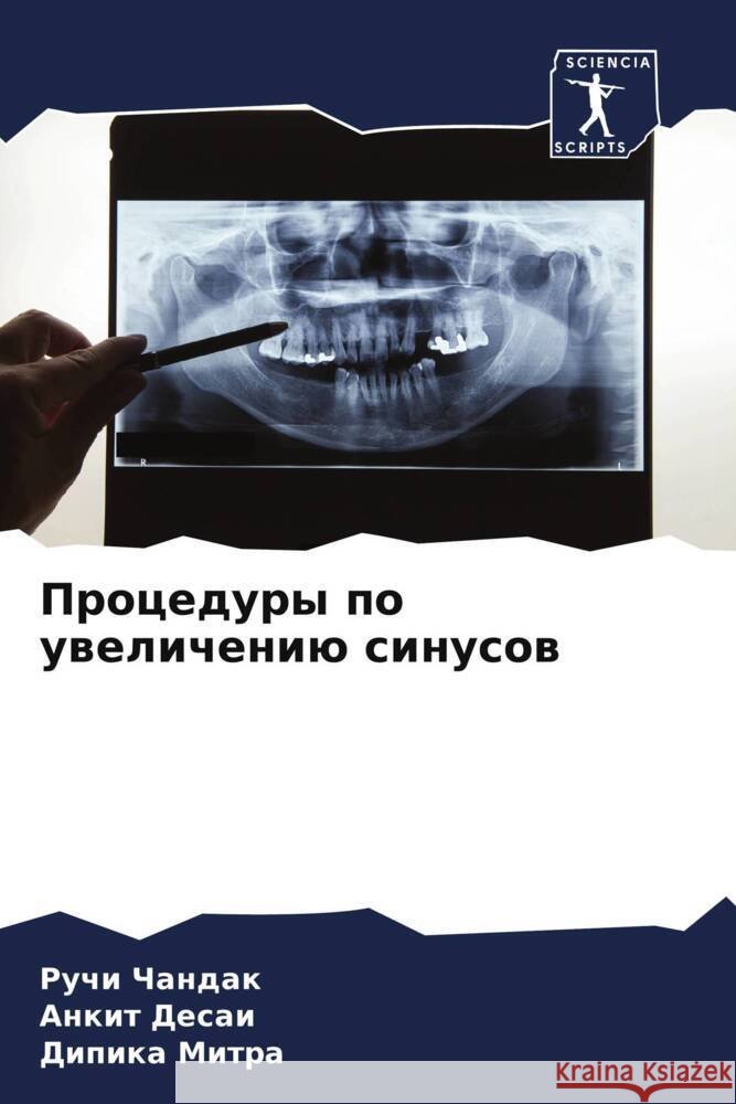Procedury po uwelicheniü sinusow Chandak, Ruchi, Desai, Ankit, Mitra, Dipika 9786206045441 Sciencia Scripts