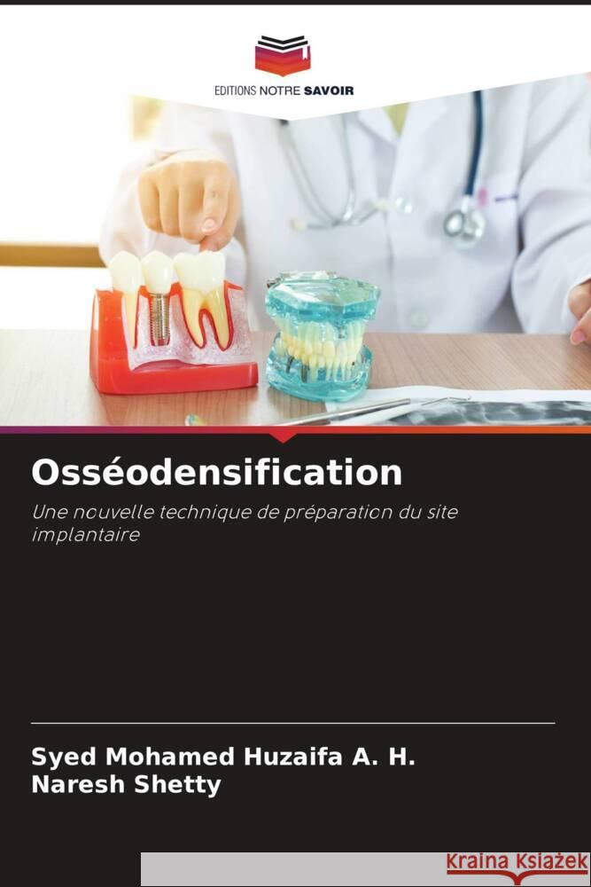 Osseodensification Syed Mohamed Huzaifa A H Naresh Shetty  9786206047964 Editions Notre Savoir