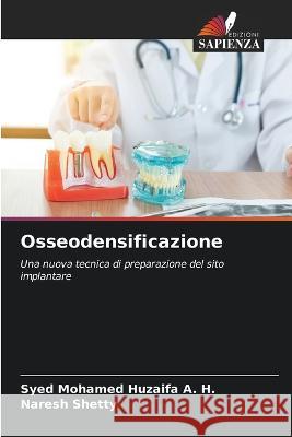 Osseodensificazione Syed Mohamed Huzaifa A H Naresh Shetty  9786206047971 Edizioni Sapienza