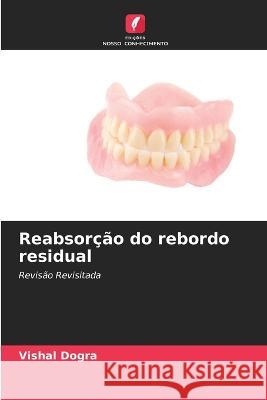 Reabsorcao do rebordo residual Vishal Dogra   9786206049913