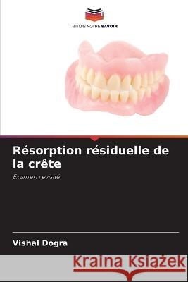 Resorption residuelle de la crete Vishal Dogra   9786206049944