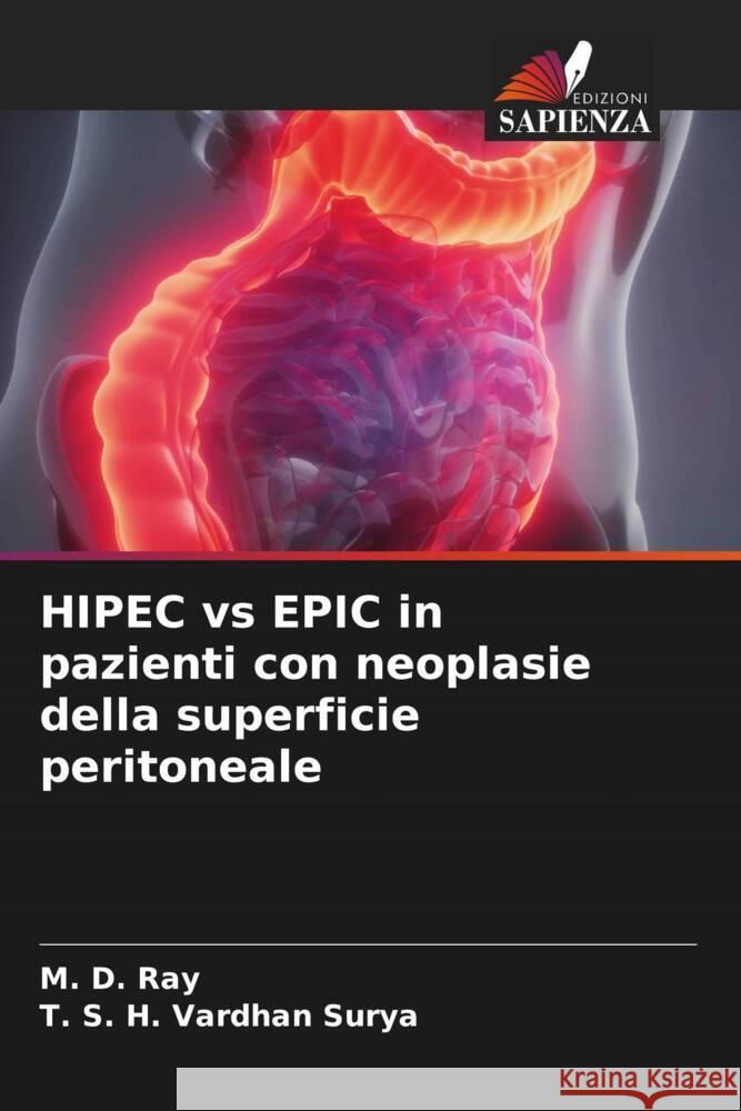 HIPEC vs EPIC in pazienti con neoplasie della superficie peritoneale M D Ray T S H Vardhan Surya  9786206053767 Edizioni Sapienza