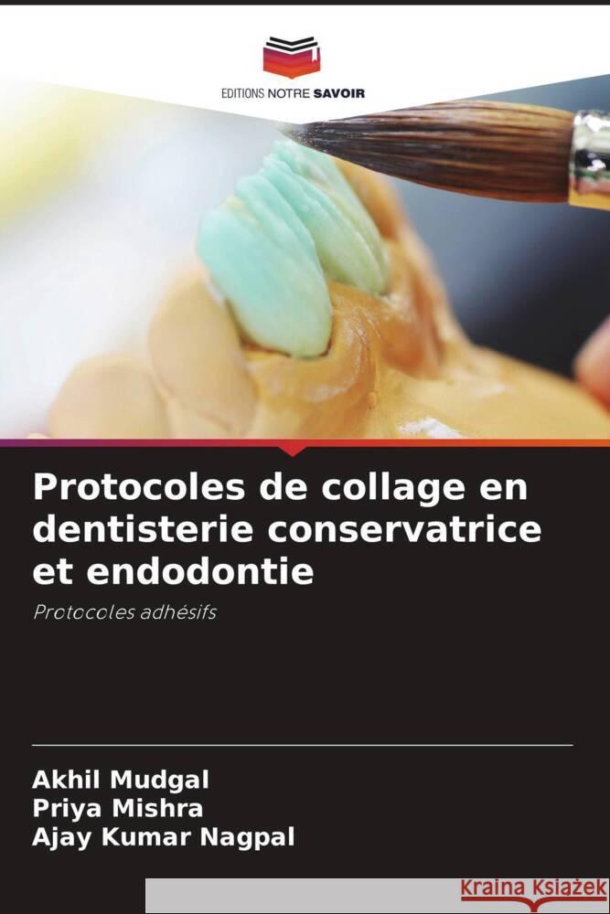 Protocoles de collage en dentisterie conservatrice et endodontie Akhil Mudgal Priya Mishra Ajay Kumar Nagpal 9786206054597