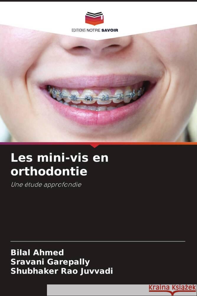 Les mini-vis en orthodontie Bilal Ahmed Sravani Garepally Shubhaker Rao Juvvadi 9786206057123