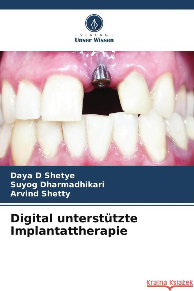 Digital unterstutzte Implantattherapie Daya D Shetye Suyog Dharmadhikari Arvind Shetty 9786206069751