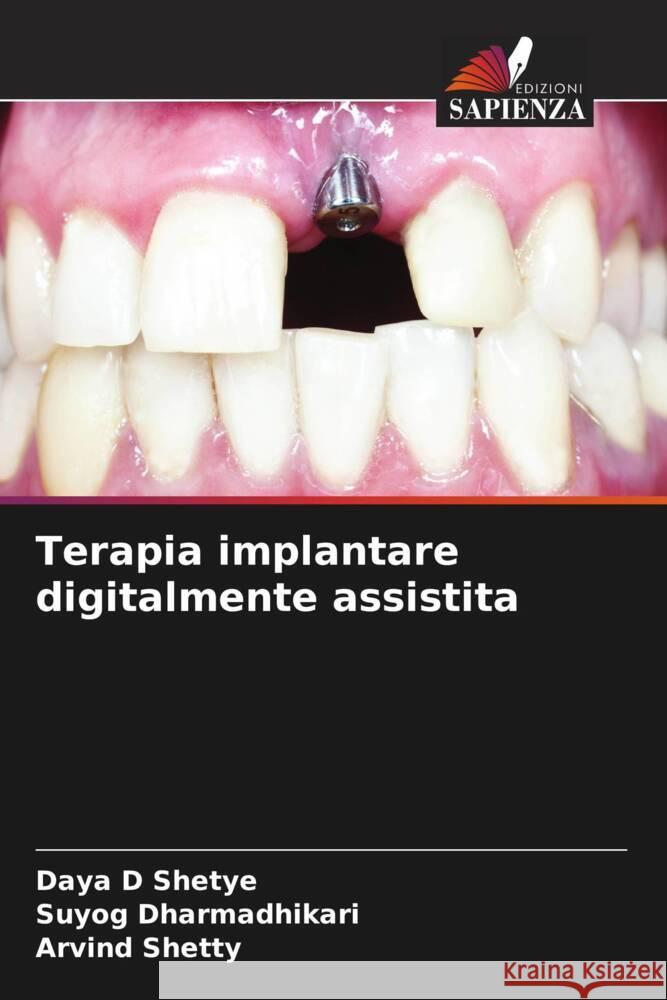 Terapia implantare digitalmente assistita Daya D Shetye Suyog Dharmadhikari Arvind Shetty 9786206069782