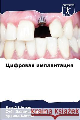 Cifrowaq implantaciq Shetye, Daq D, Dharmadhikari, Suög, Shetty, Arwind 9786206069799
