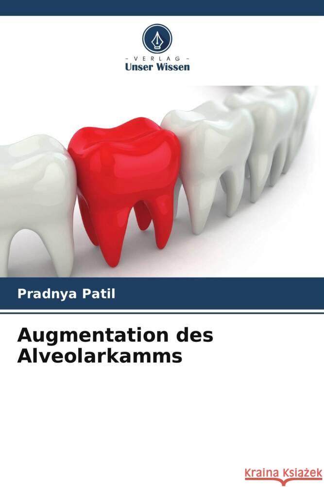 Augmentation des Alveolarkamms Pradnya Patil   9786206071792