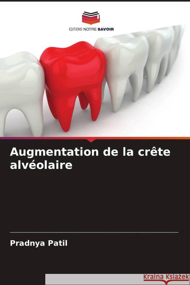 Augmentation de la crete alveolaire Pradnya Patil   9786206071808