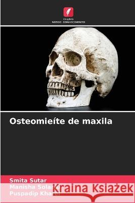 Osteomieite de maxila Smita Sutar Manisha Solanki Puspadip Kharel 9786206076230