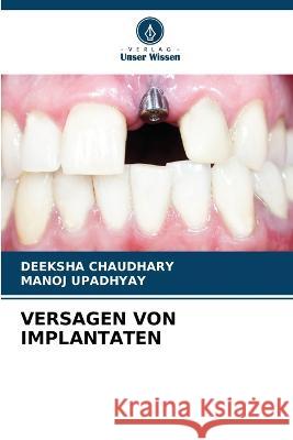 Versagen Von Implantaten Deeksha Chaudhary Manoj Upadhyay  9786206083917