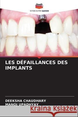 Les Defaillances Des Implants Deeksha Chaudhary Manoj Upadhyay  9786206083924