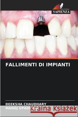 Fallimenti Di Impianti Deeksha Chaudhary Manoj Upadhyay  9786206084020