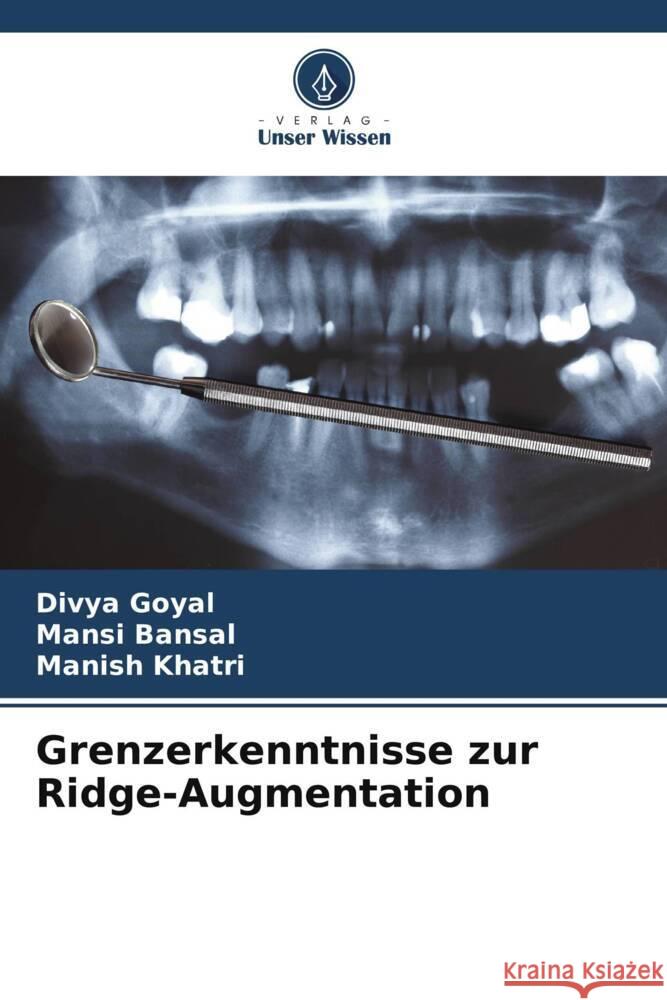 Grenzerkenntnisse zur Ridge-Augmentation Divya Goyal Mansi Bansal Manish Khatri 9786206086789 Verlag Unser Wissen