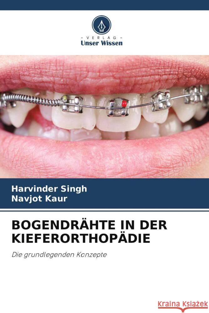 Bogendrahte in Der Kieferorthopadie Harvinder Singh Navjot Kaur  9786206088417