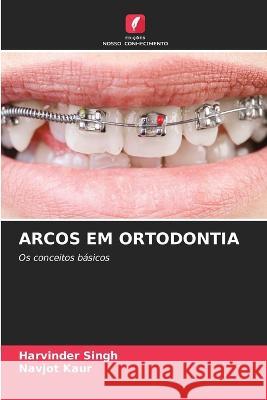 Arcos Em Ortodontia Harvinder Singh Navjot Kaur  9786206088455 Edicoes Nosso Conhecimento