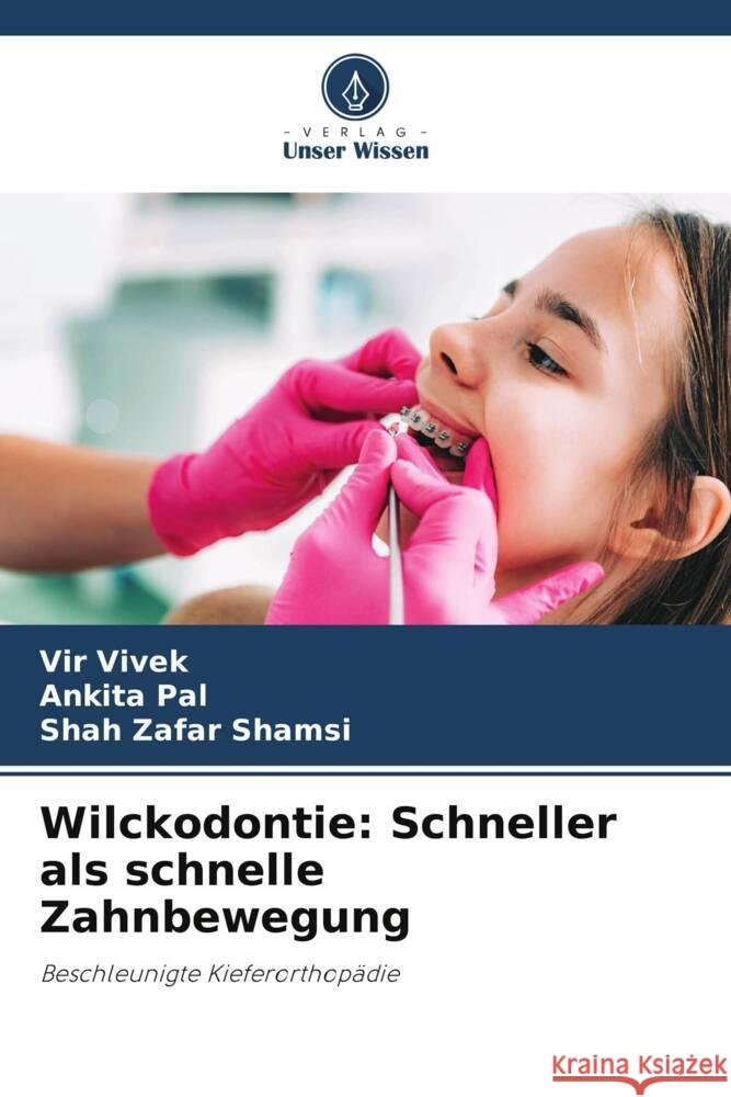 Wilckodontie: Schneller als schnelle Zahnbewegung Vir Vivek Ankita Pal Shah Zafar Shamsi 9786206092315