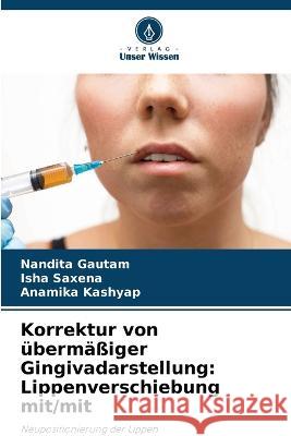 Korrektur von ubermassiger Gingivadarstellung: Lippenverschiebung mit/mit Nandita Gautam Isha Saxena Anamika Kashyap 9786206094593 Verlag Unser Wissen