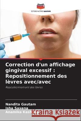 Correction d'un affichage gingival excessif: Repositionnement des levres avec/avec Nandita Gautam Isha Saxena Anamika Kashyap 9786206094616 Editions Notre Savoir