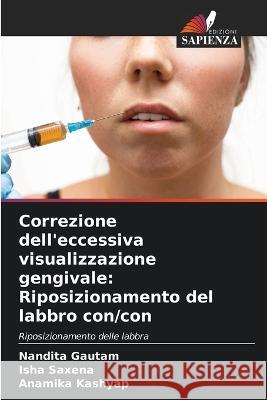 Correzione dell'eccessiva visualizzazione gengivale: Riposizionamento del labbro con/con Nandita Gautam Isha Saxena Anamika Kashyap 9786206094623 Edizioni Sapienza