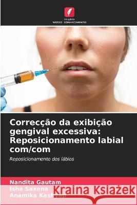 Correccao da exibicao gengival excessiva: Reposicionamento labial com/com Nandita Gautam Isha Saxena Anamika Kashyap 9786206094630 Edicoes Nosso Conhecimento