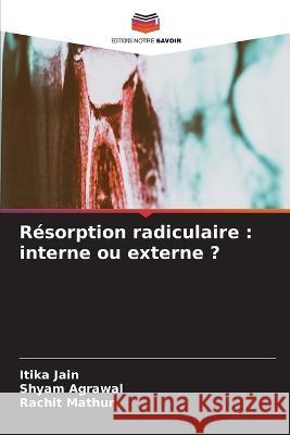 Resorption radiculaire: interne ou externe ? Itika Jain Shyam Agrawal Rachit Mathur 9786206097907 Editions Notre Savoir