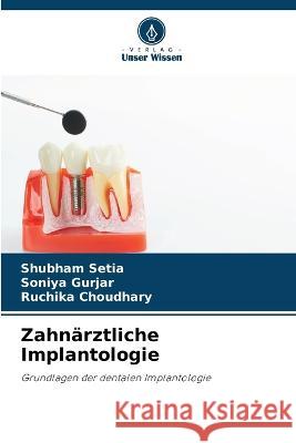 Zahnarztliche Implantologie Shubham Setia Soniya Gurjar Ruchika Choudhary 9786206103998