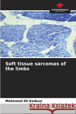 Soft tissue sarcomas of the limbs Mohamed Ali Kedous   9786206110033