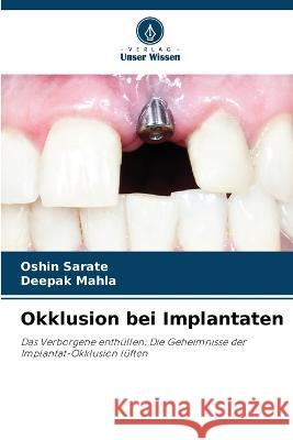 Okklusion bei Implantaten Oshin Sarate Deepak Mahla  9786206119838