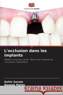 L'occlusion dans les implants Oshin Sarate Deepak Mahla  9786206119852